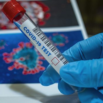 Covid-19, il punto sui test rapidi
