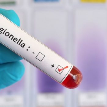 Legionella: strategie efficaci per la valutazione, la gestione e l’intervento nei rischi