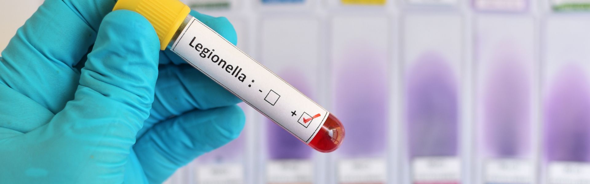 Legionella: strategie efficaci per la valutazione, la gestione e l’intervento nei rischi